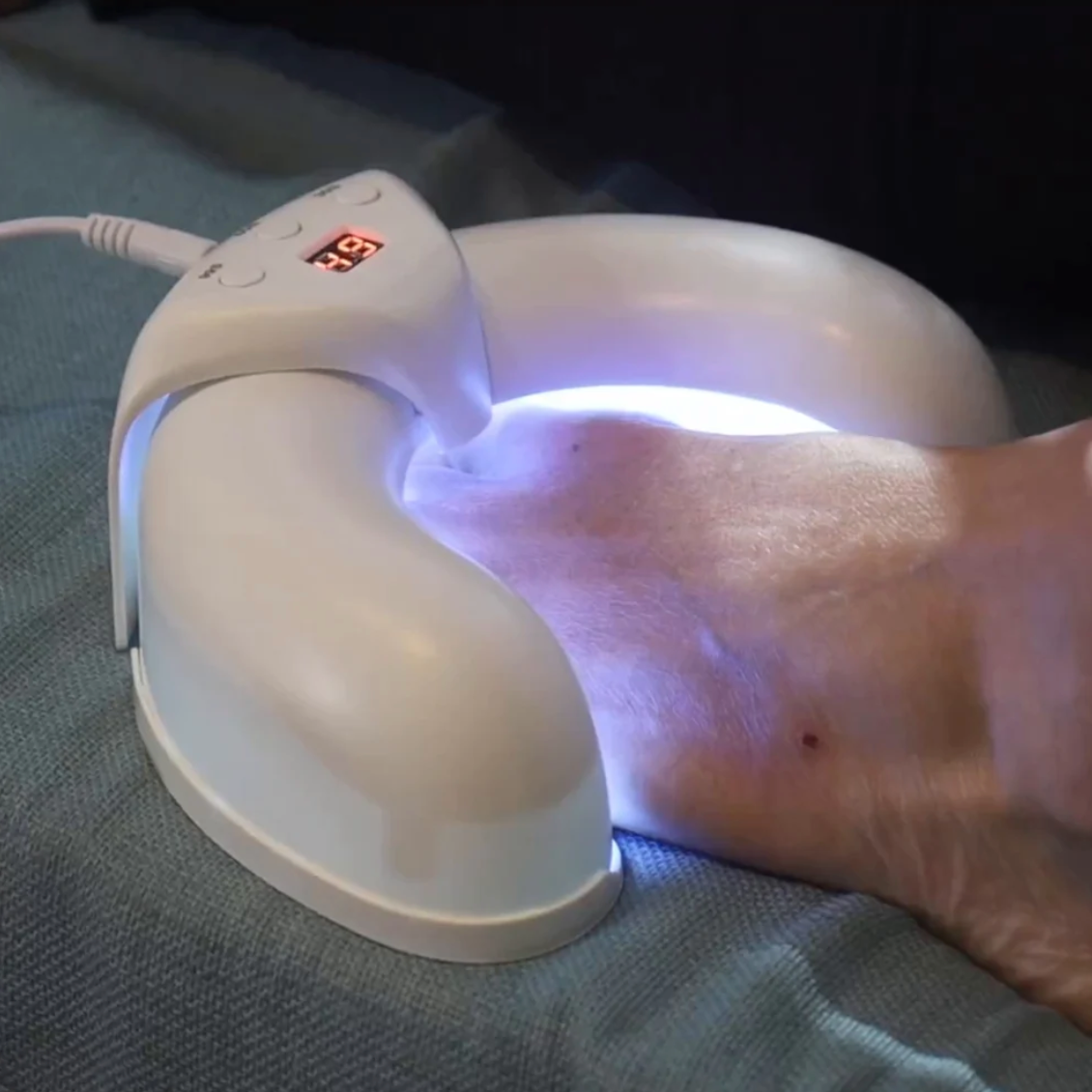 PODOlight® | LLLT-Nagelpilztherapie